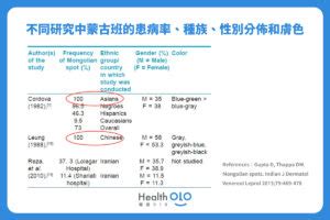 大腿胎記|胎記怎麼產生、何時消除？醫師剖析胎記種類、胎記寓意